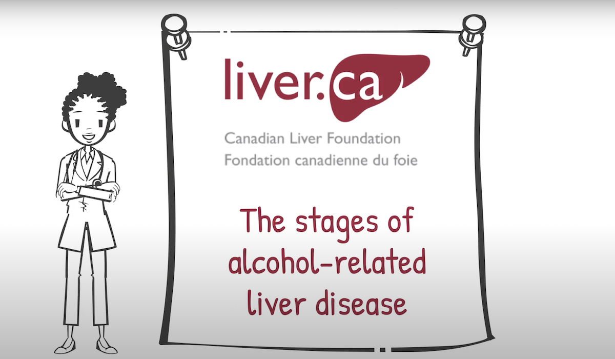 the-different-stages-of-alcohol-related-liver-disease-canadian-liver