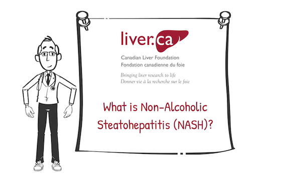 what-is-non-alcoholic-steatohepatitis-nash-canadian-liver-foundation